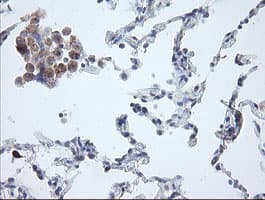 APP / Beta Amyloid Precursor Antibody (clone OTI4C9)