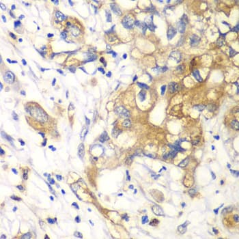 IHC-plus™ KLK10 / Kallikrein 10 Antibody