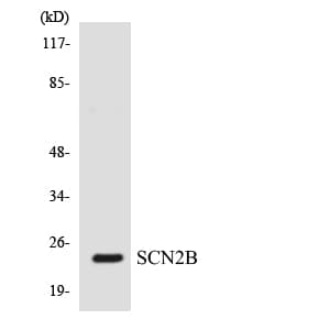 SCN2B Antibody (aa55-104)