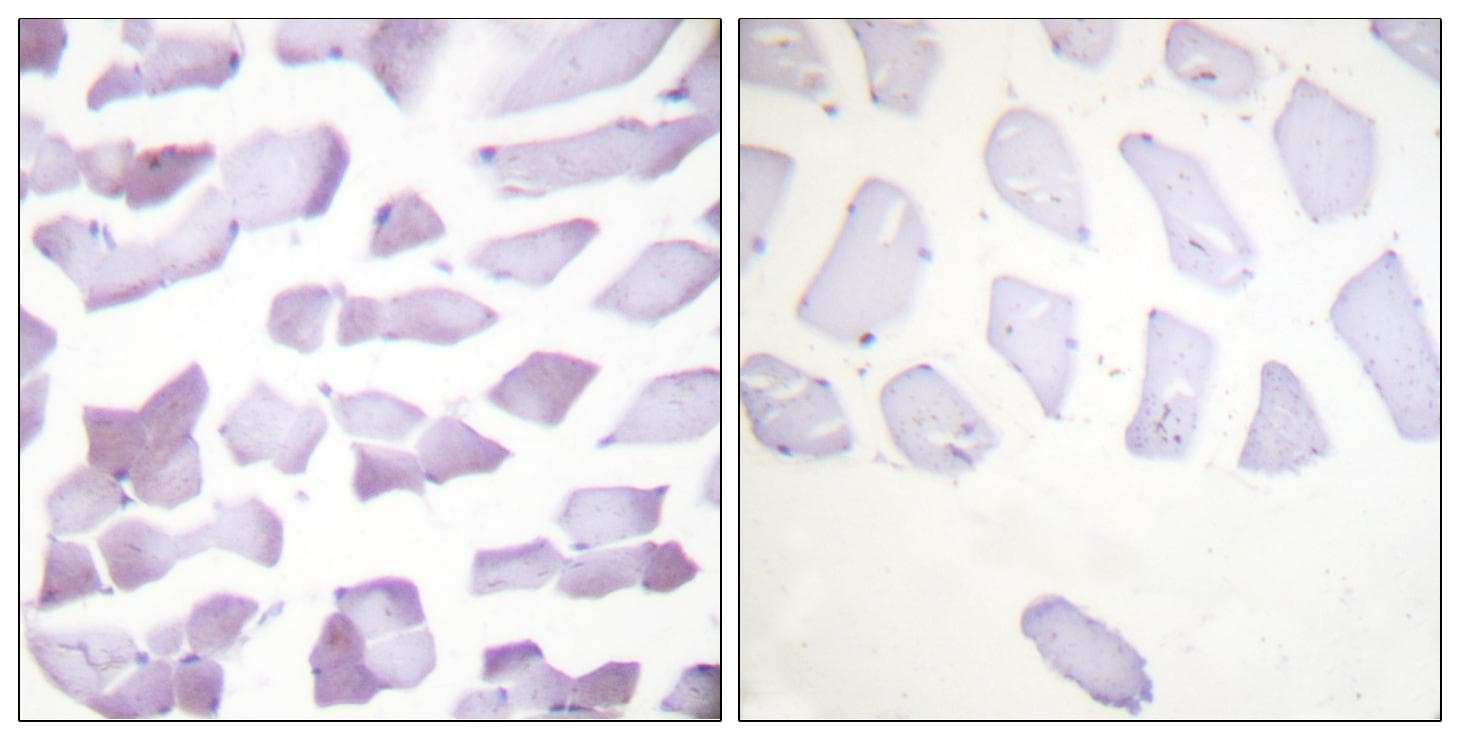 CHUK / IKKA / IKK Alpha Antibody (Ab-176/177)