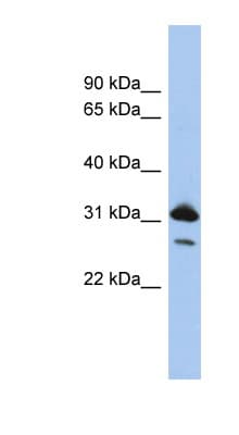 RAP1B Antibody (N-Terminus)