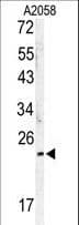 MOB1A Antibody (aa188-216)