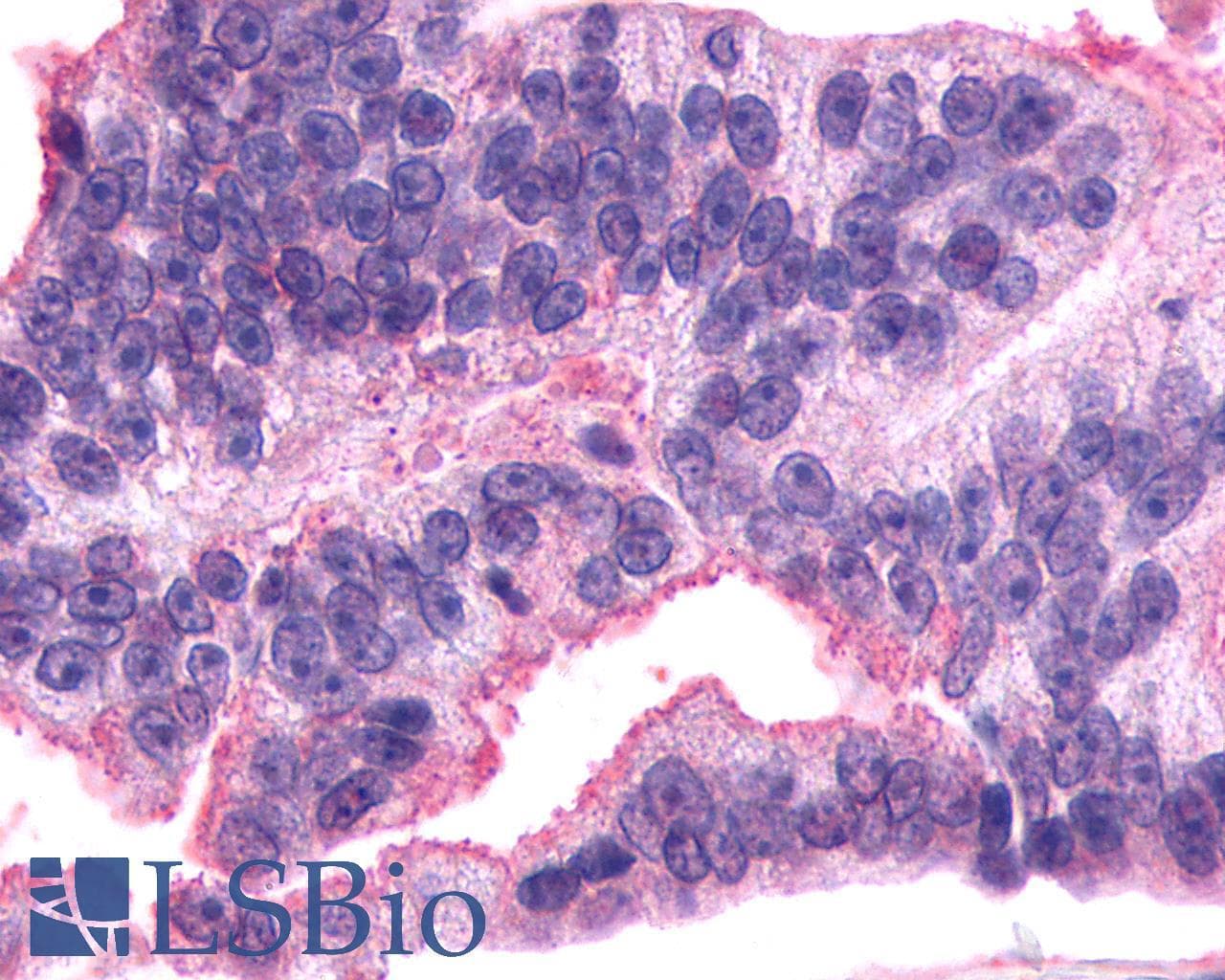 Polyclonal Rabbit anti-Human AVPR2 / V2R Antibody (Cytoplasmic Domain, IHC)