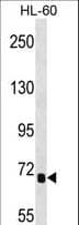 Polyclonal Rabbit anti-Human IL1RAPL2 Antibody (aa376-405, WB)