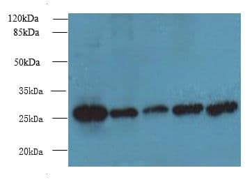 Polyclonal Rabbit anti-Human TBCB / CKAP1 Antibody (IHC, WB)
