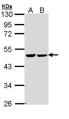 IHC-plus™ FH / Fumarase / MCL Antibody (aa89-365)