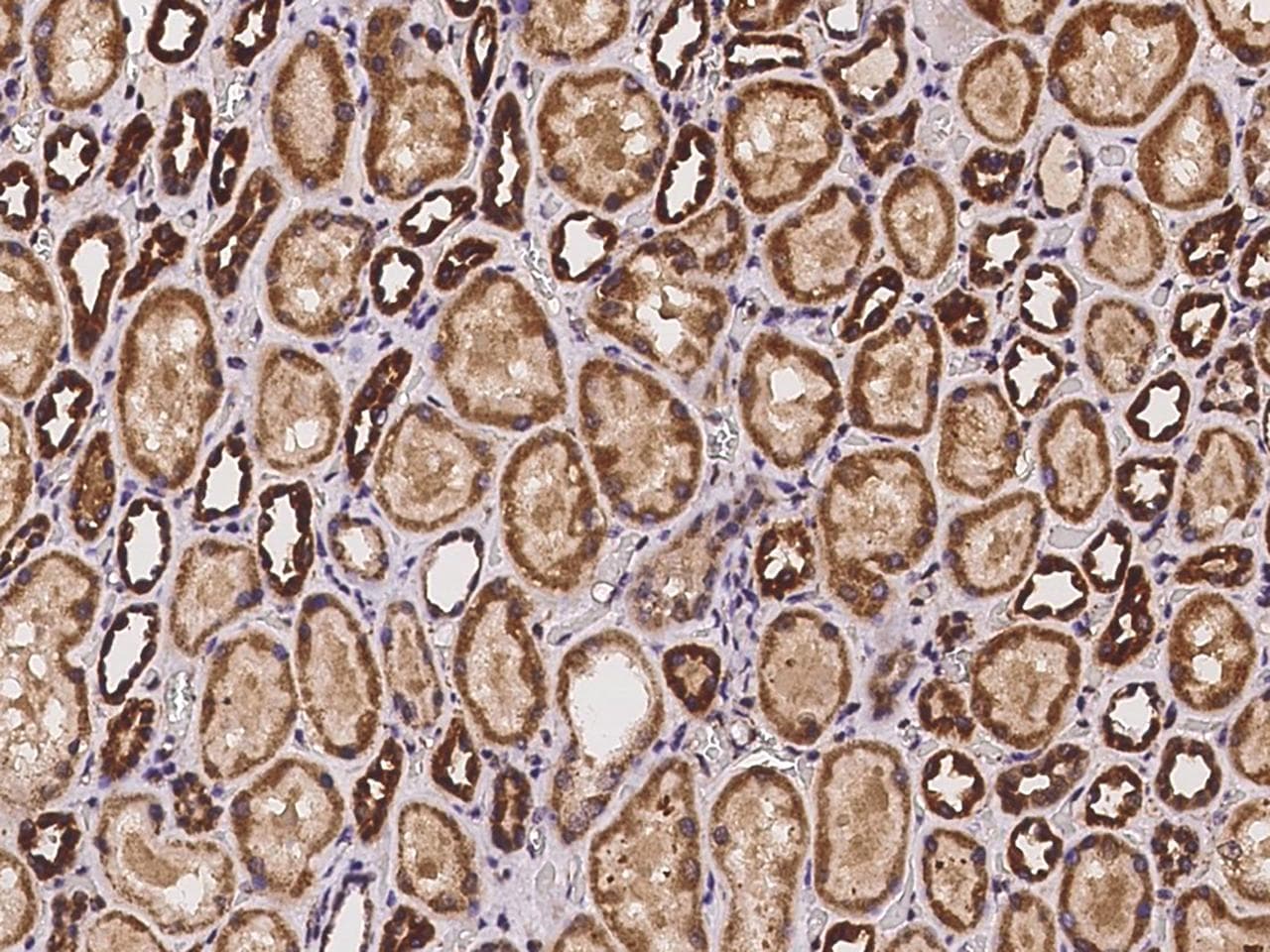Polyclonal Rabbit anti-Human DCUN1D2 Antibody (IHC)