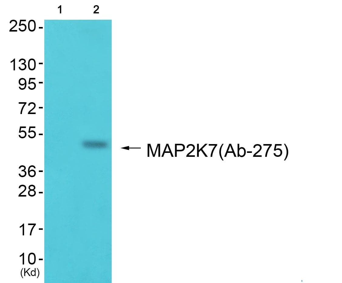 MAP3K7 / TAK1 Antibody (p275)