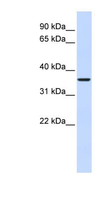 Polyclonal Rabbit anti-Human FBP2 Antibody (aa216-265, WB)