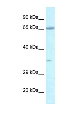 LZTS1 Antibody (aa530-579)