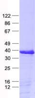 Human FBG4 / FBXO17 Protein (Recombinant His, N-Terminal)
