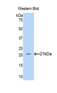 NRP1 / Neuropilin 1 Antibody (aa646-814)