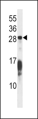 Polyclonal Rabbit anti-Human RAP1B Antibody (aa150-178, WB)