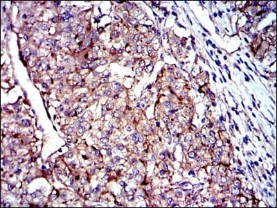 CD9 Antibody (clone 5G6)