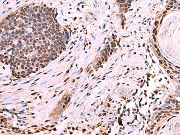 NASP Antibody