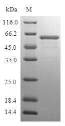 Human FBP1 Protein (Recombinant GST, N-terminus)