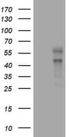 VEGFC Antibody (aa112-227, clone OTI4A1)