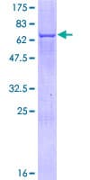 Human SPOP Protein (Recombinant GST)