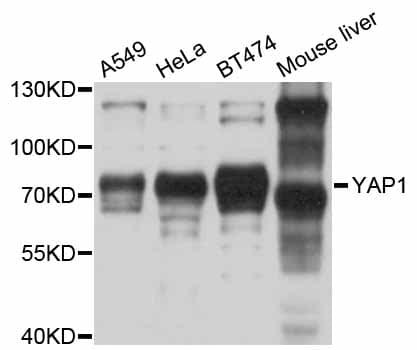 YAP / YAP1 Antibody