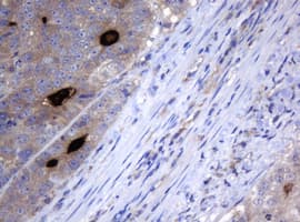 MAGEA3 Antibody (clone OTI3B2, Carrier-free)