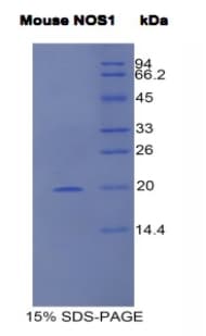 Mouse NOS1 / nNOS Protein (Recombinant His)
