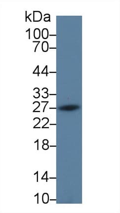 PD-L2 / PDCD1LG2 / CD273 Antibody (aa21-268)