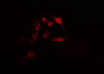 Polyclonal Rabbit anti-Human IFI16 Antibody (IF, WB)