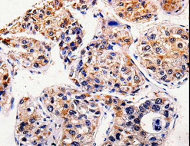 AP1B1 / BAM22 Antibody