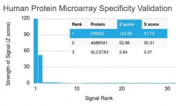 ERBB2 / HER2 Antibody (clone ERBB2/2453)