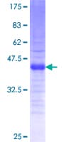 Human TWIST2 Protein (Recombinant GST, N-terminus)