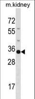 POU5F2 Antibody (aa203-231)
