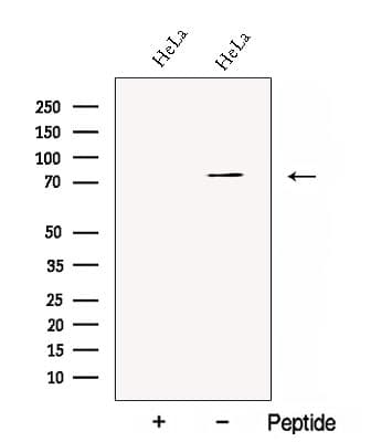 CBFA2T2 / MTGR1 Antibody