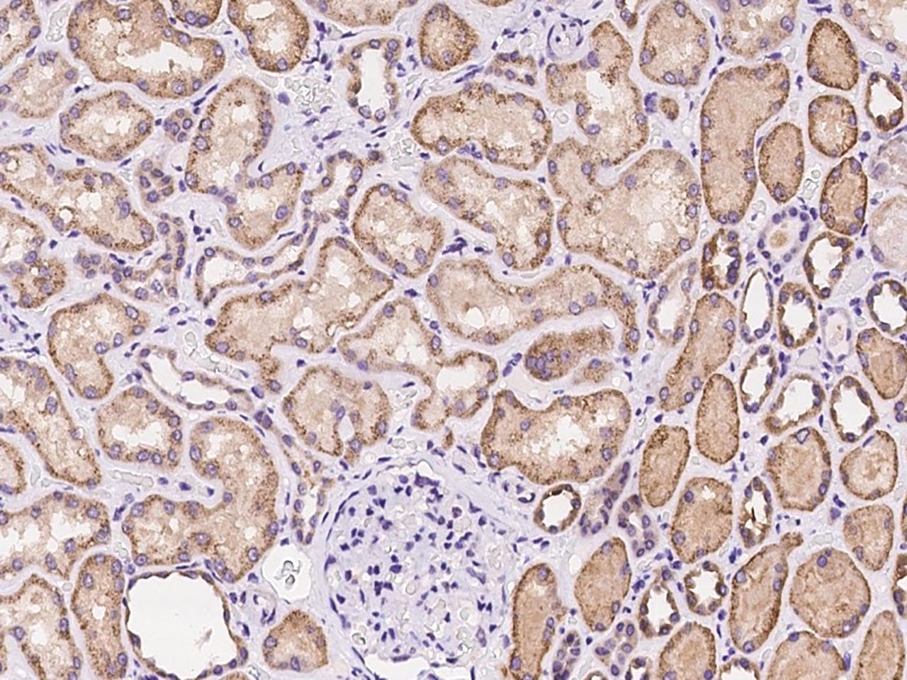 SLC22A7 / OAT2 Antibody