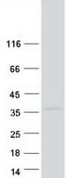 Human HOXC9 Protein (Recombinant Myc-DDK (Flag))