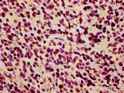 Polyclonal Rabbit anti-Human HIST1H2AI Antibody (IF, WB)