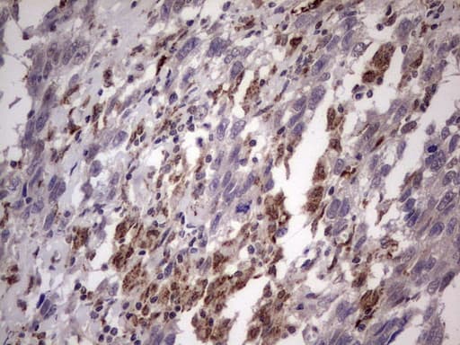 Monoclonal Mouse anti-Human ALDP / ABCD1 Antibody (clone OTI5G6, aa508-745, IHC, WB)