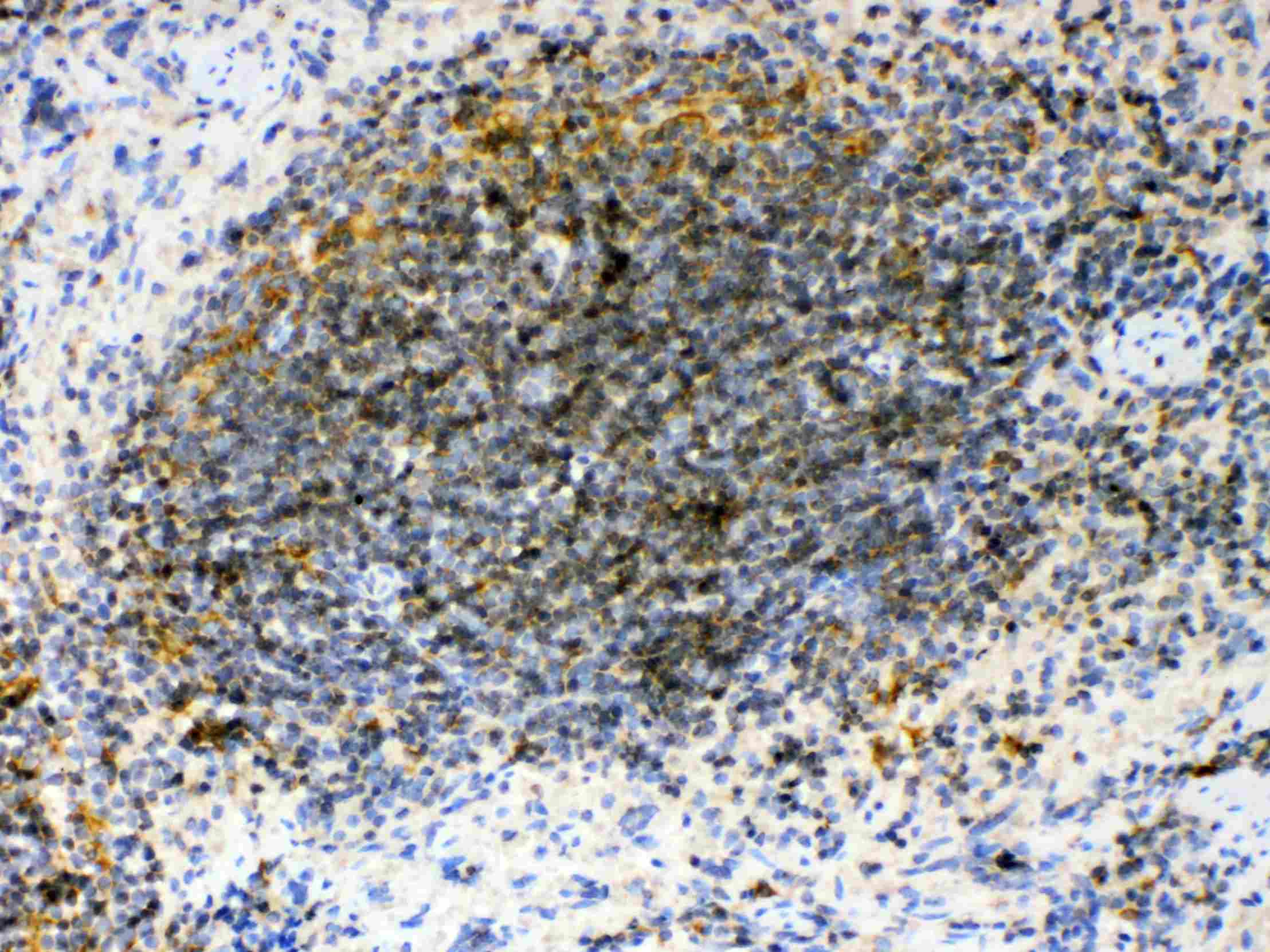 GAS6 Antibody