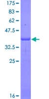 Human IL4R / CD124 Protein (Recombinant GST, N-terminus)