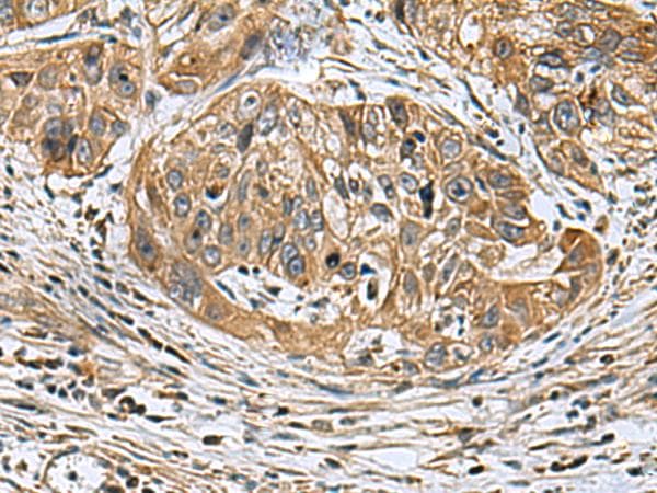 KIAA1970 / EARS2 Antibody