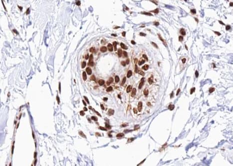 DDIT3 / CHOP Antibody (phospho-Ser30)