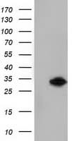 KHK / Ketohexokinase Antibody (clone OTI3D1)
