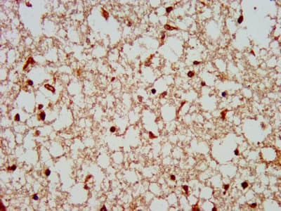 COPS8 / COP9 Antibody