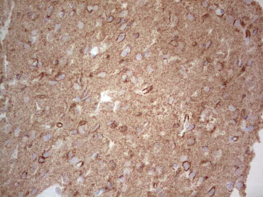 Monoclonal Mouse anti-Human NCAM / CD56 Antibody (clone OTI1B9, aa20-718, IHC, WB)