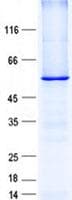 Human TRIM62 Protein (Recombinant His, N-Terminal)
