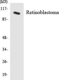 PathPlus™ RB1 / Retinoblastoma / RB Antibody (aa552-601)