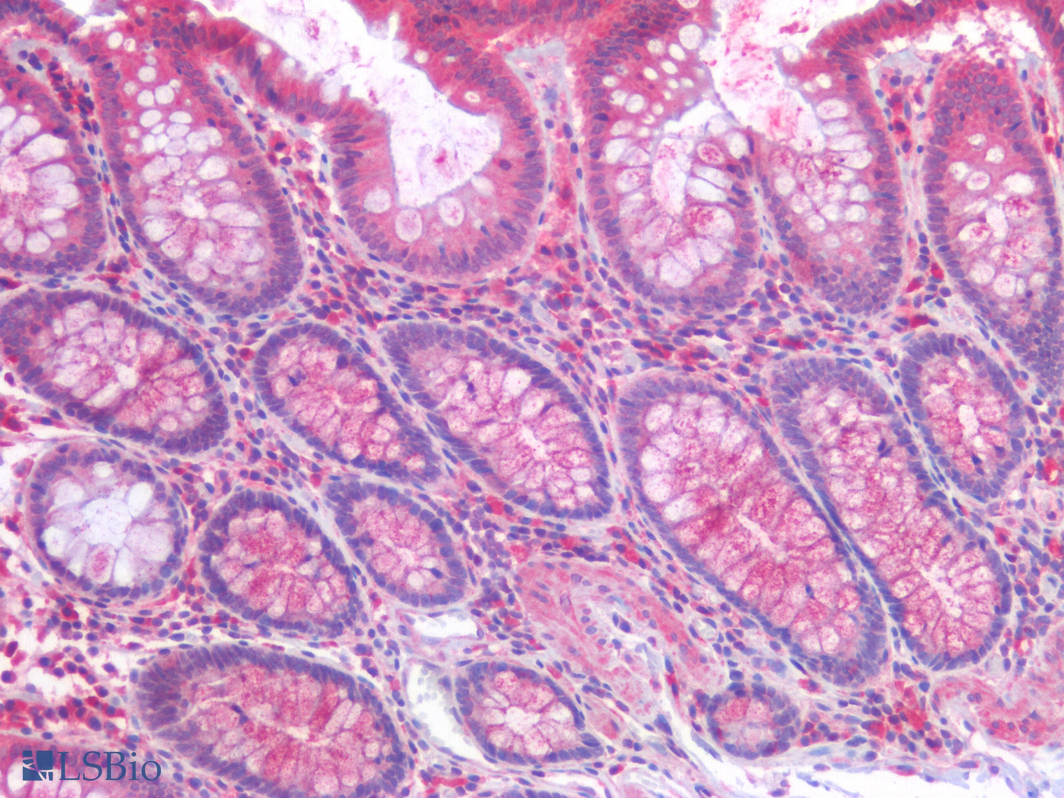 PathPlus™ Polyclonal Rabbit anti-Human HAVCR1 / KIM-1 Antibody (IHC)
