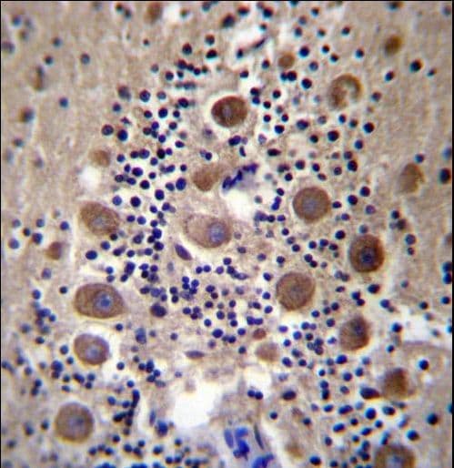 GASP2 / GPRASP2 Antibody (aa234-263)