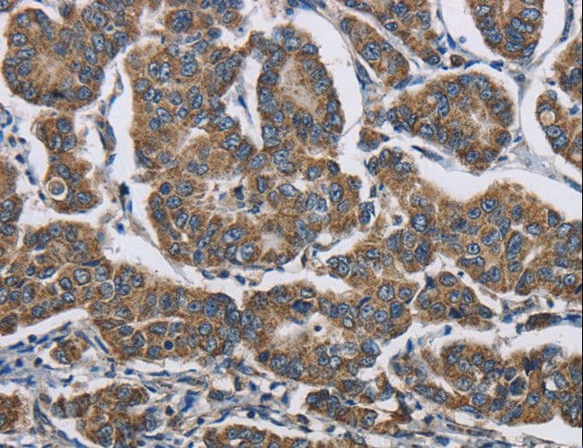 Polyclonal Rabbit anti-Human AGER / RAGE Antibody (IHC, WB)