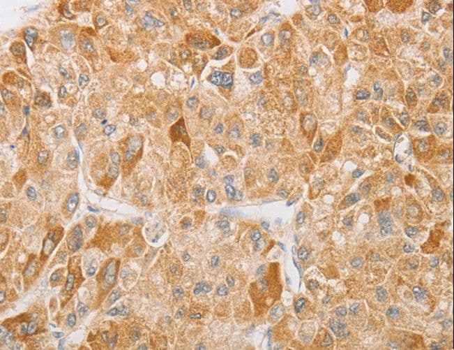 NGF Antibody