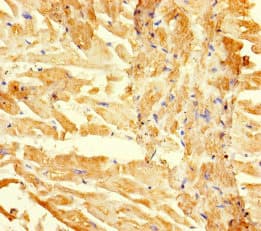 Polyclonal Rabbit anti-Human RGMA Antibody